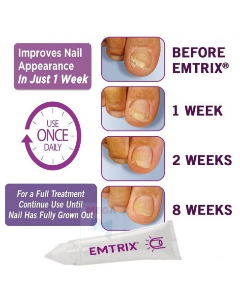 Emtrix Fungal Nail Treatment 10ML