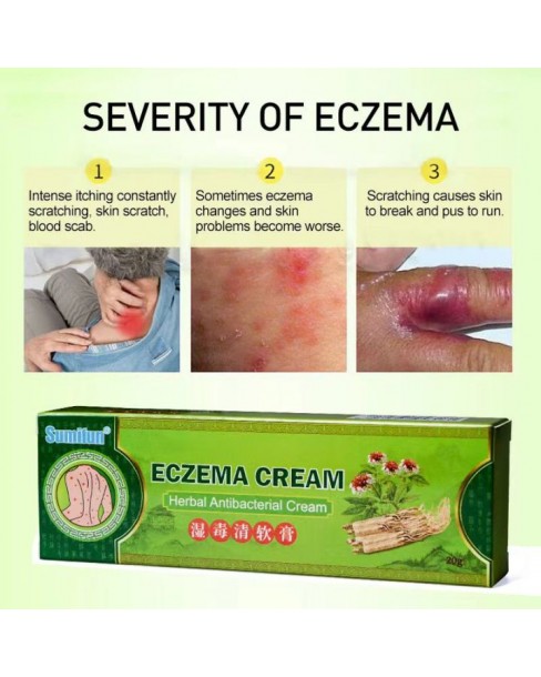 Sumifun Eczema Cream Herbal Antibacterial Cream Psoriasis Itchy